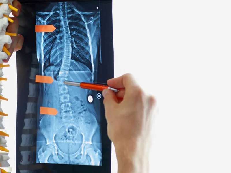 Centro Quiropráctico QuiroVida