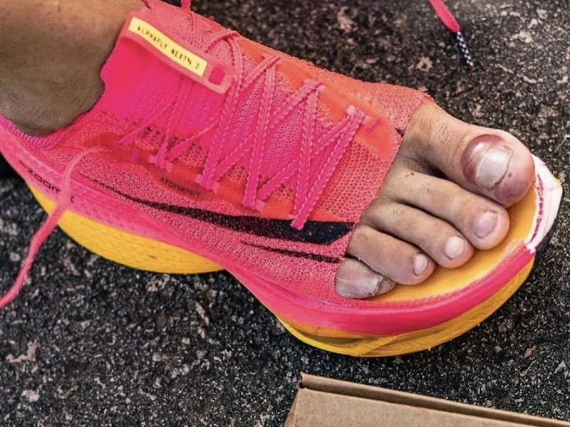 LimaFeet Podología Clínica