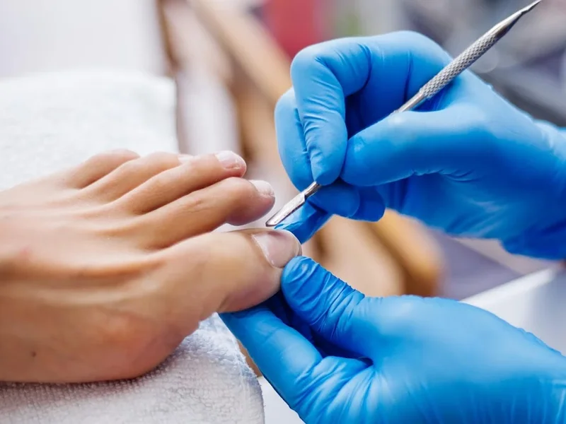 Podología Integral Surco