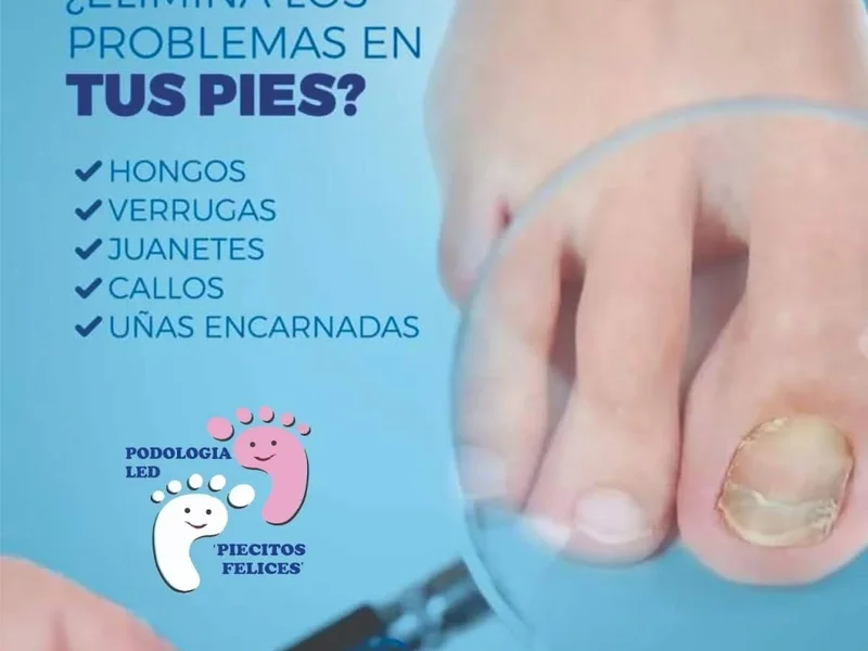 Podologia Laser Piecitos Felices y Podologia Laser Pies Sanos