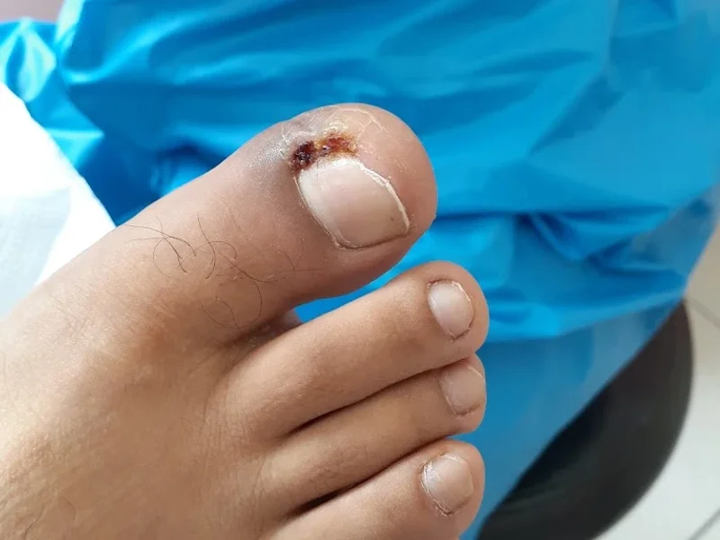 PODOBELL-PODOLOGÍA INTEGRAL