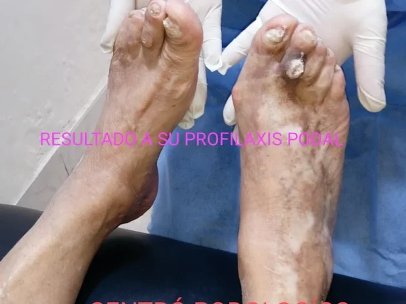 Podologia, Salón Spa Deisy