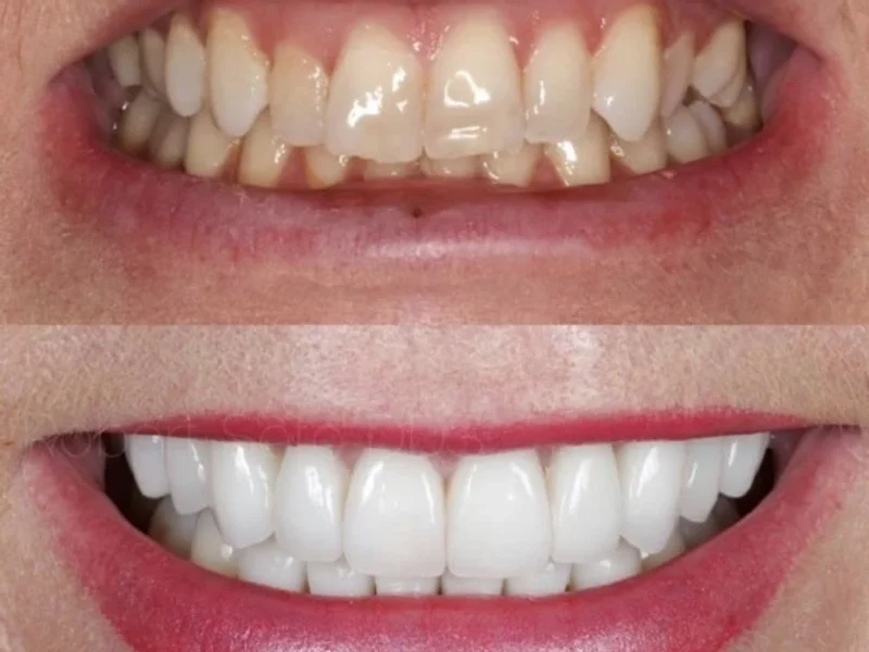 Dr. Kevin Benites Ramirez, Dentista