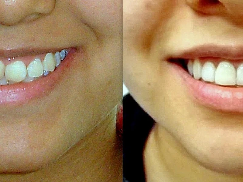 Consultorio de Ortodoncia Bernuy Sede Santa Beatriz