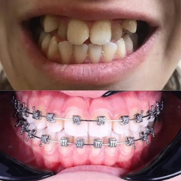 Clínica de las Sonrisas - Brackets, Implantes dentales, Diseño de Sonrisa en Lima Norte