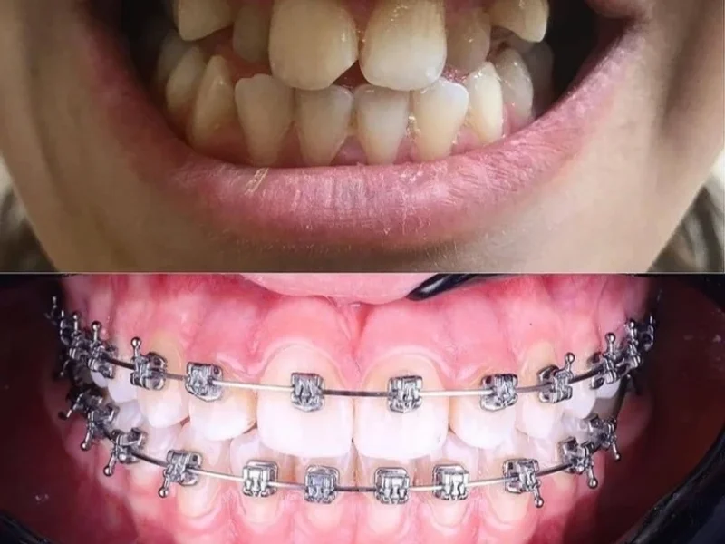 Clínica de las Sonrisas - Brackets, Implantes dentales, Diseño de Sonrisa en Lima Norte