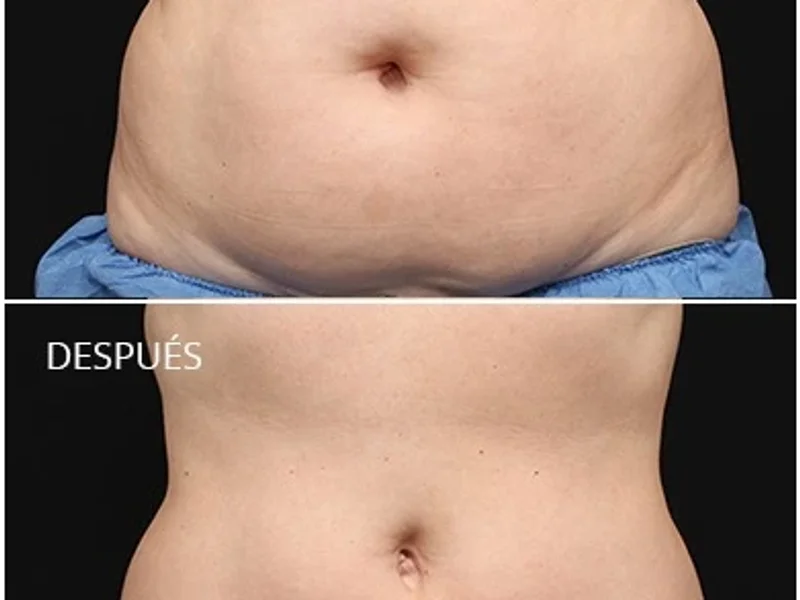 Masoterapia y Estética Nayu