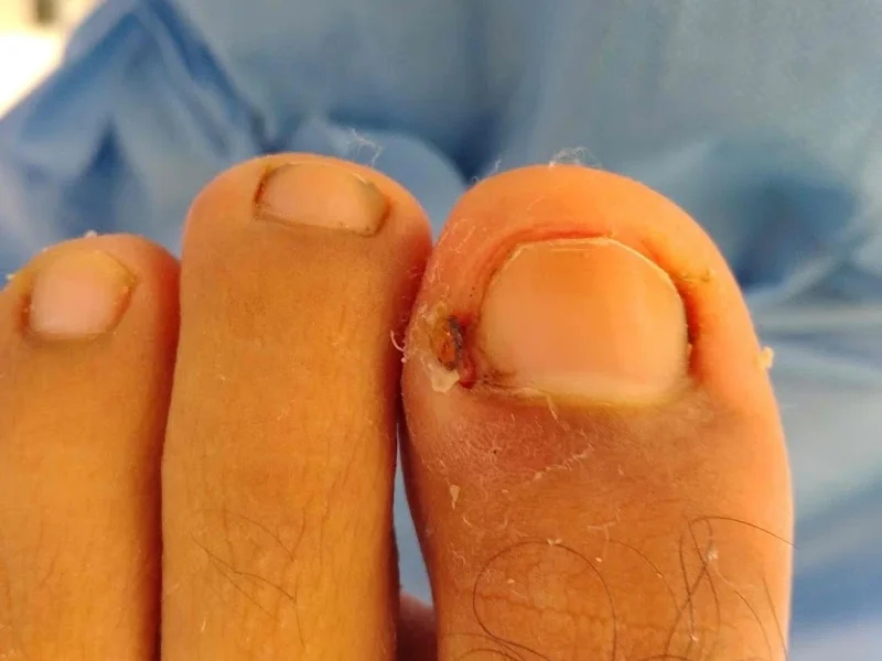 Podología Integral - Esther Del Castillo