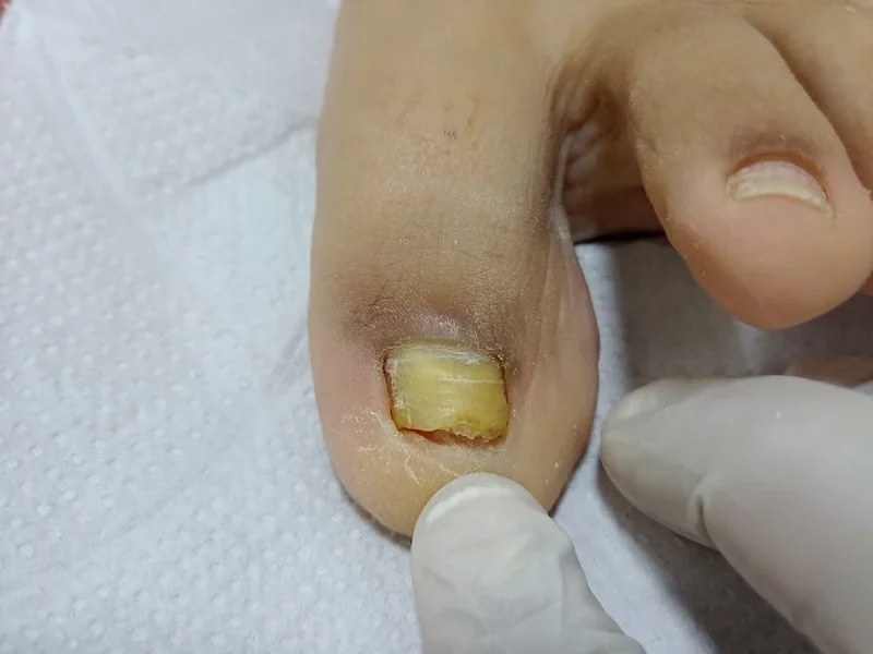 Podologia clínic Anita