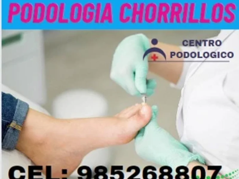 PODOLOGIA CHORRILLOS - Consultorio Podologíco Santa Rosa
