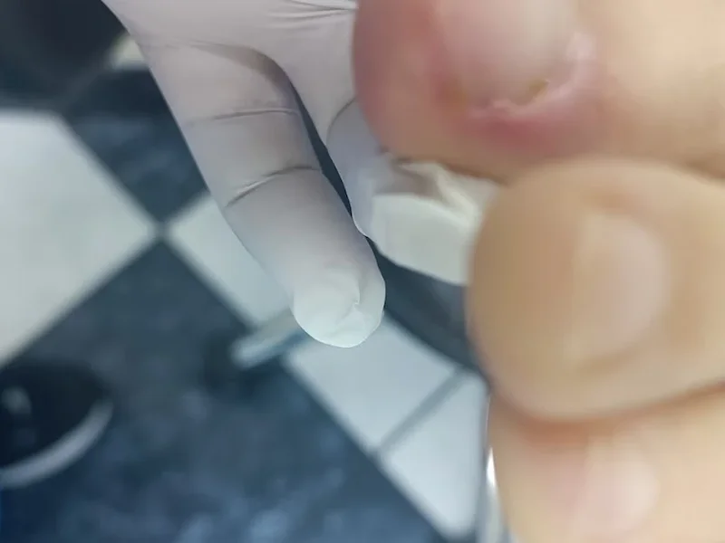 Centro Podologico PIE