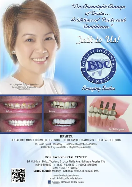 BONIFACIO DENTAL CENTER - Angeles City, Pampanga Dentist