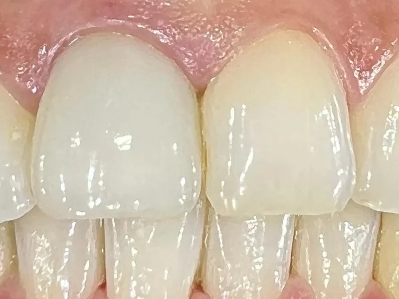 Instituto Implantologia Oral Doutor Thomas Schreiner