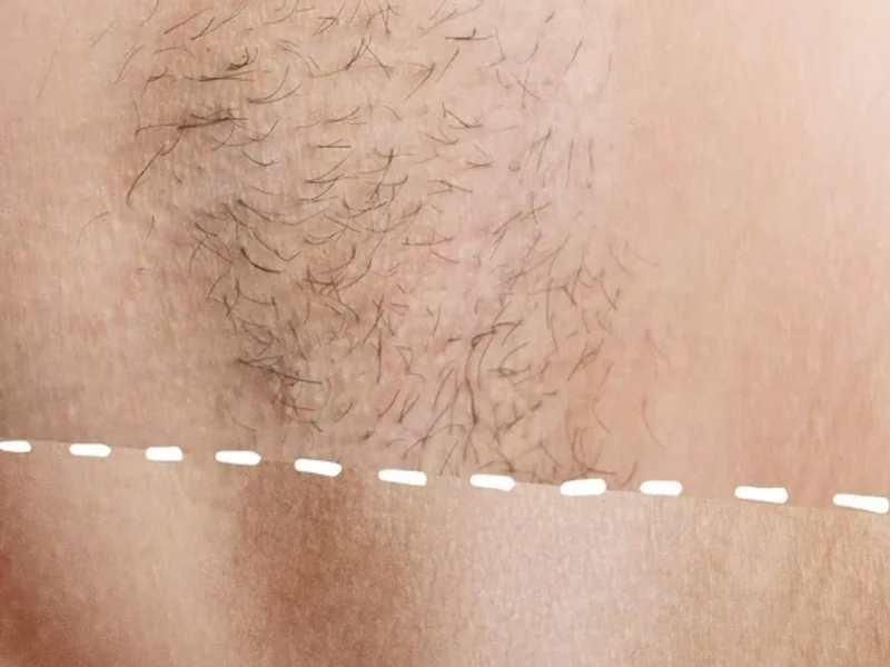 Centro Laser Matosinhos