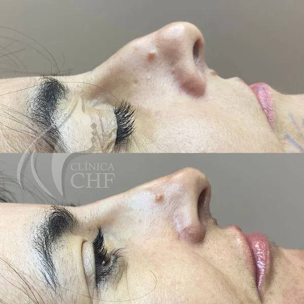 Clínica CHF Viseu - Harmonização e Rejuvenescimento Facial