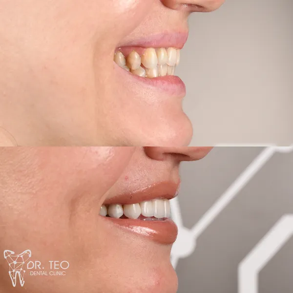 Dr. Teo Dental Clinic IASI | Clinica Stomatologica - Ortodonție, Fațete Dentare, Implantologie