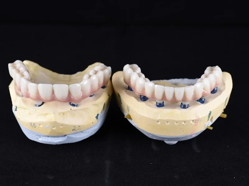 Ilieș Dental Clinic - Clinica Dentara Brașov | Implant Dentar Brasov