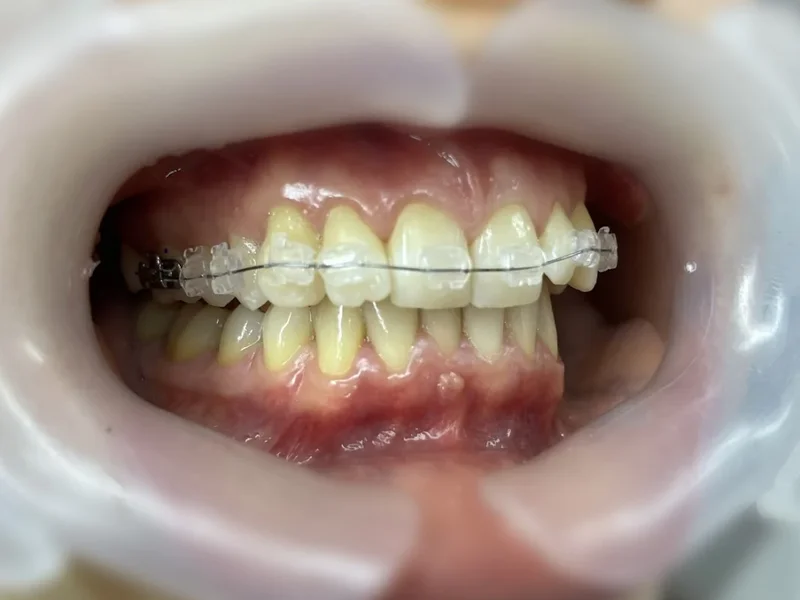 Cabinet Stomatologie Brasov - Florident