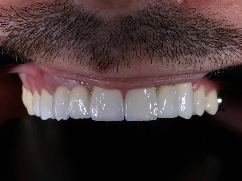 ZEIN DENT CLINIC DR SAMED ZEINEDDIN (stomatologie non stop)