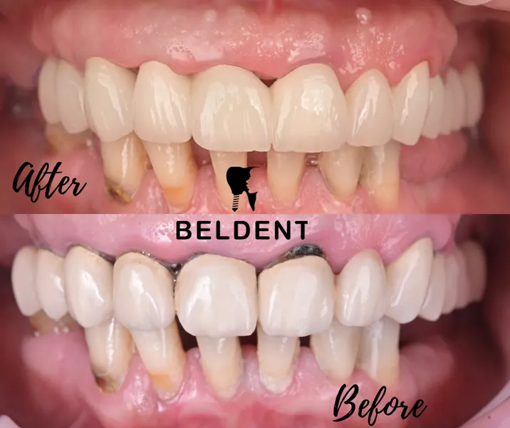 Bel-DENT Clinic