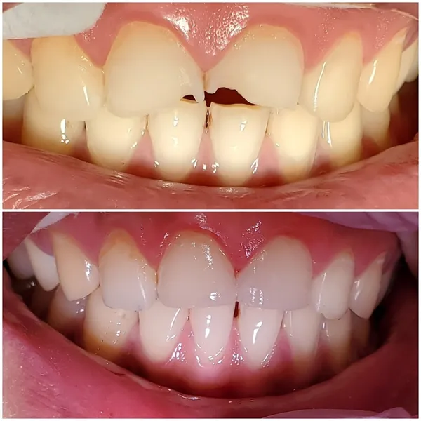 D Dental Care --------- Diana Yeung D.D.S. 楊安娜牙醫博士 - 安和牙科診所