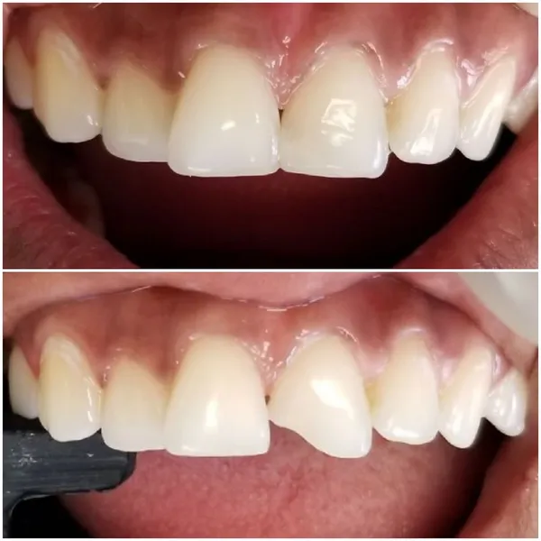 Dr. Andrew Fundo - Joy of Smile Dentistry