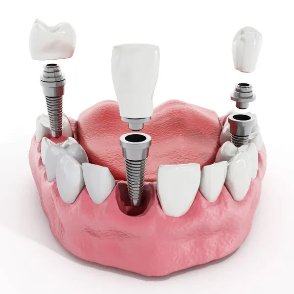 Kipnis Dental - Dr. Marina Kipnis DDS