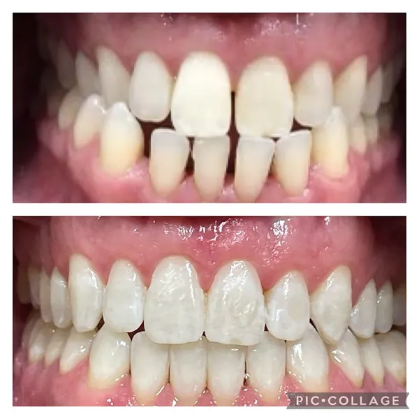 ZenDental - Alessandra Raschkovsky, DDS