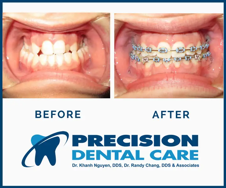 Precision Dental Care | W Belmont Ave