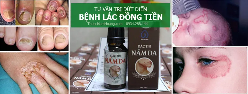 Thuốc Đông Y Nam Hoàng