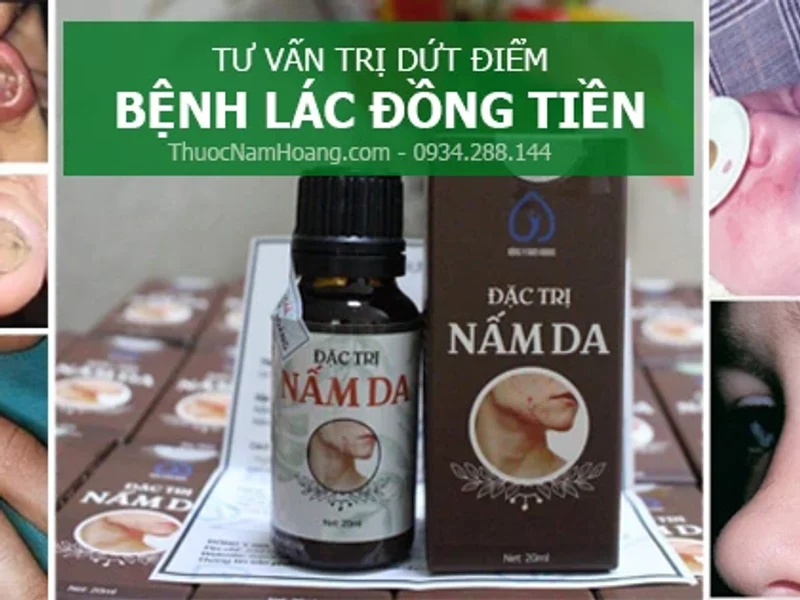 Thuốc Đông Y Nam Hoàng