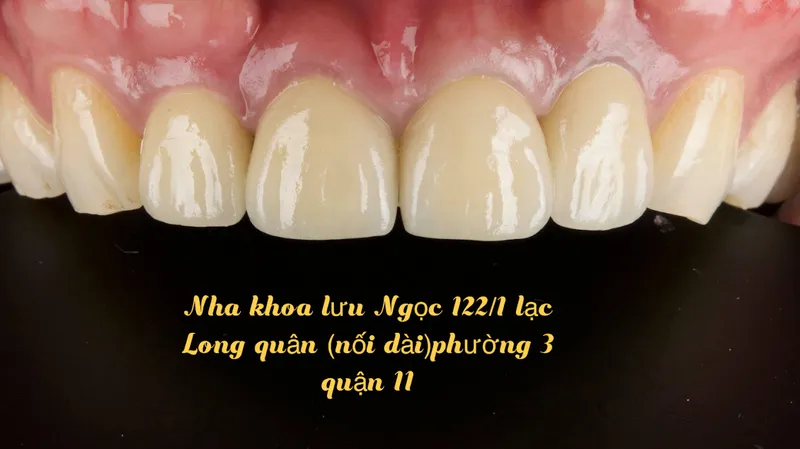 NHA KHOA LƯU NGỌC( Bs Lưu văn Ngọc)