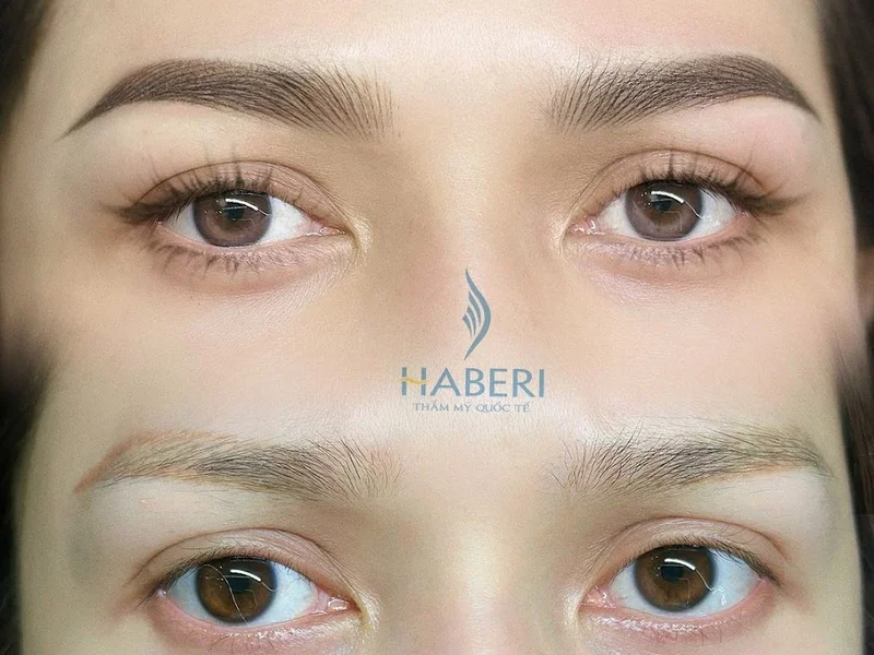 Thẩm mỹ viện Haberi