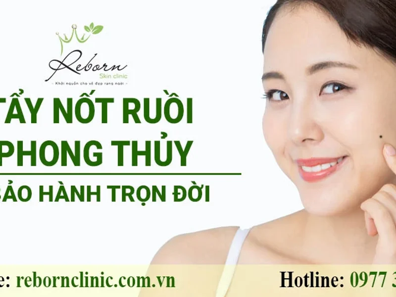 Viện REBORN - Tẩy Nốt Ruồi Có Bảo Hành
