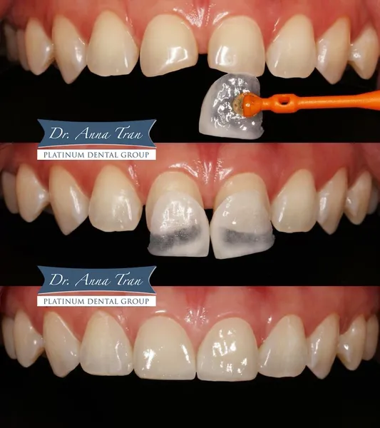 Platinum Dental - 127 Nguyễn Cư Trinh - Phòng Khám Nha Khoa Uy Tín Quận 1