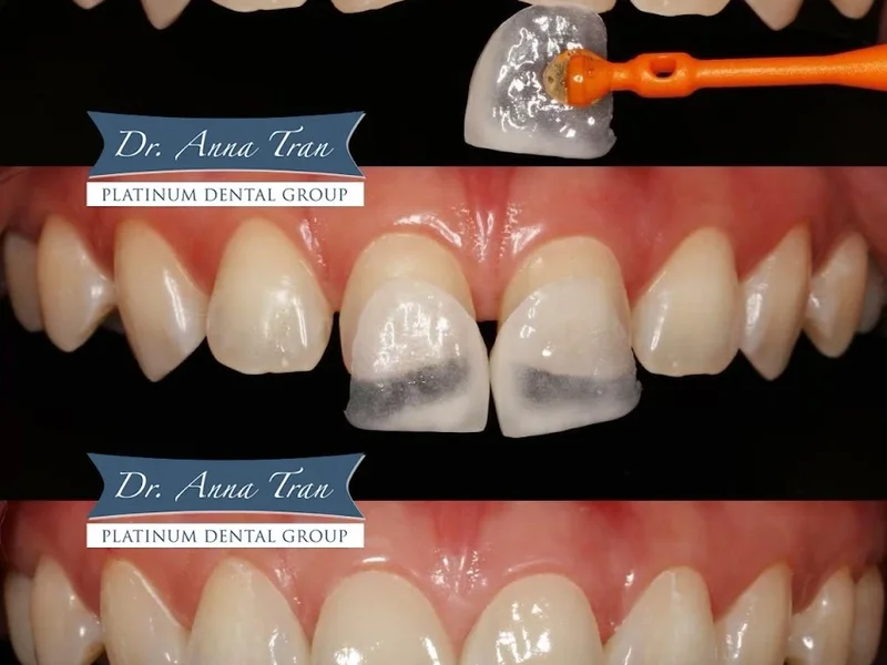 Platinum Dental - 127 Nguyễn Cư Trinh - Phòng Khám Nha Khoa Uy Tín Quận 1