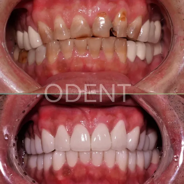 Nha Khoa ODENT - Dental Clinic | Nha khoa uy tín quận 7 | Nha khoa Niềng răng, Veneer và Cấy ghép Implant