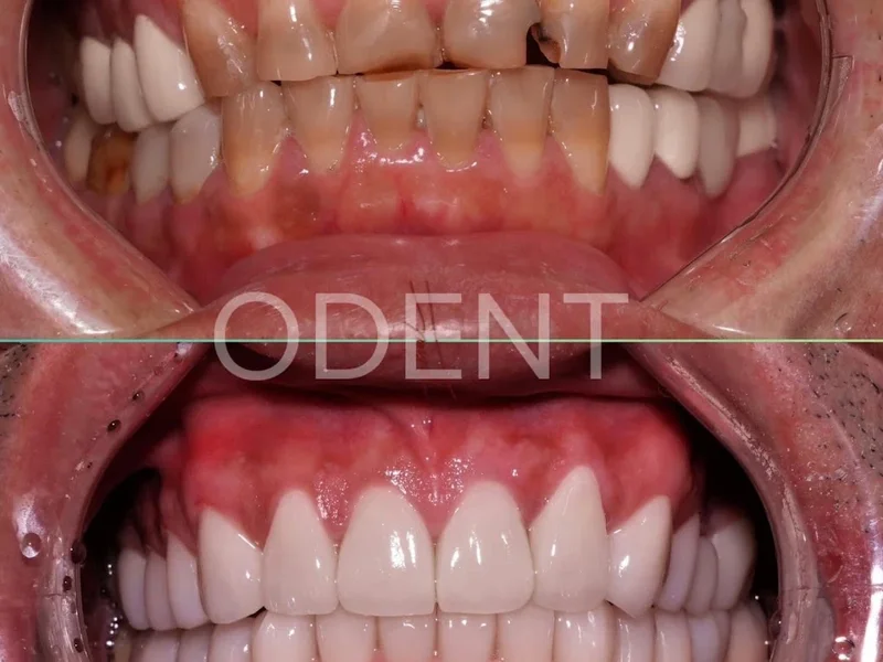 Nha Khoa ODENT - Dental Clinic | Nha khoa uy tín quận 7 | Nha khoa Niềng răng, Veneer và Cấy ghép Implant