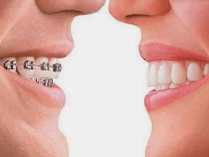 Nha Khoa AVA - Nha khoa uy tín TpHCM