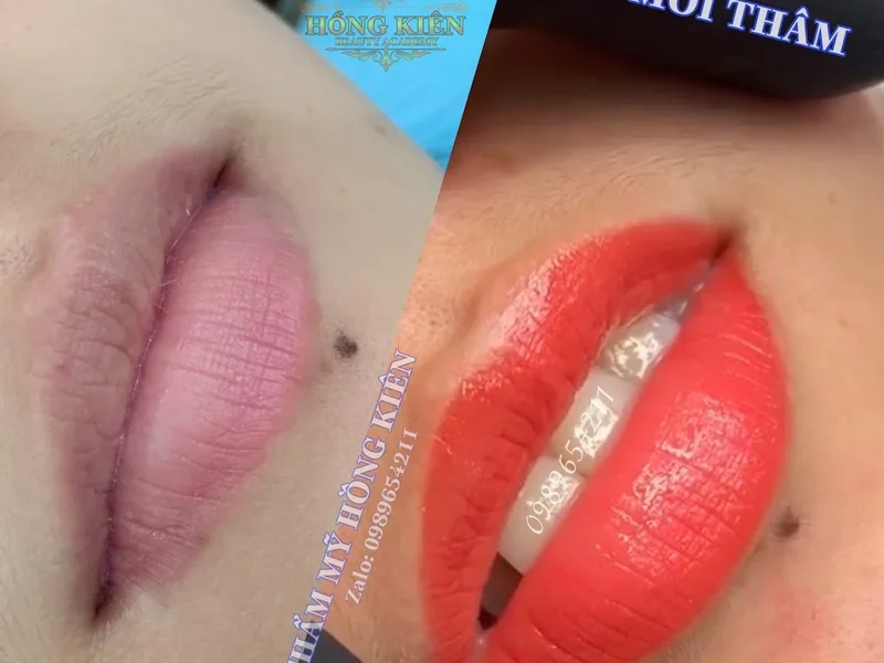Thẩm Mỹ HỒNG KIÊN - Chuyên Phun Xăm Thẩm Mỹ