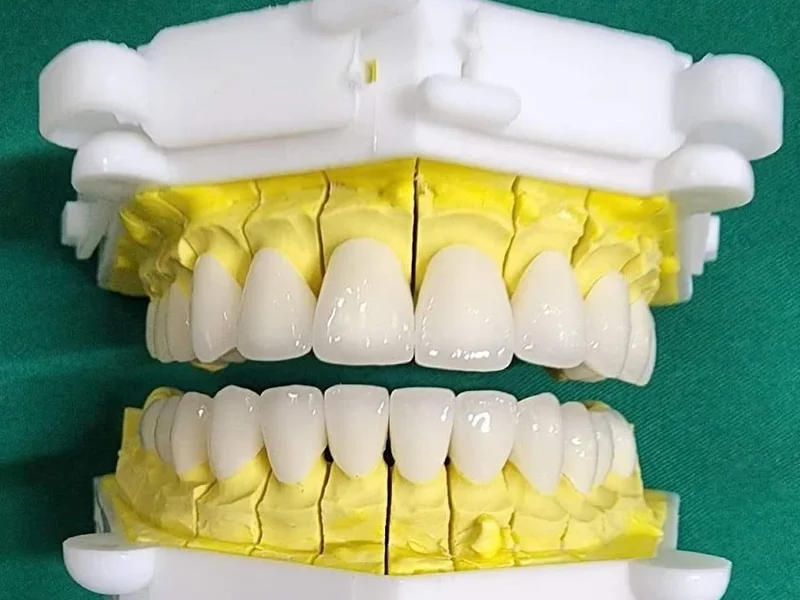 Nha Khoa Sài Gòn Bình Tân